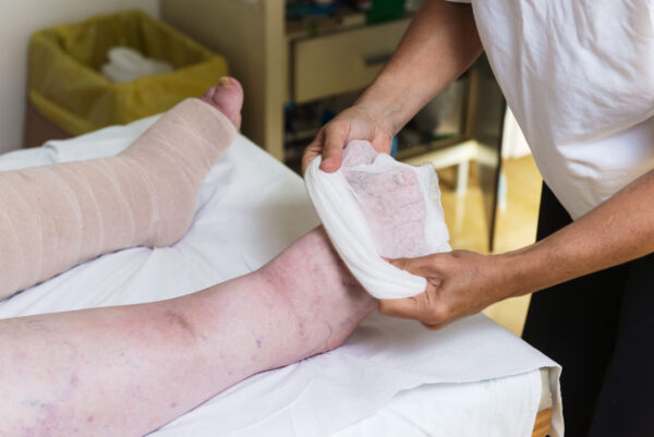 Manual Lymphatic Drainage (MLD) - Image 3